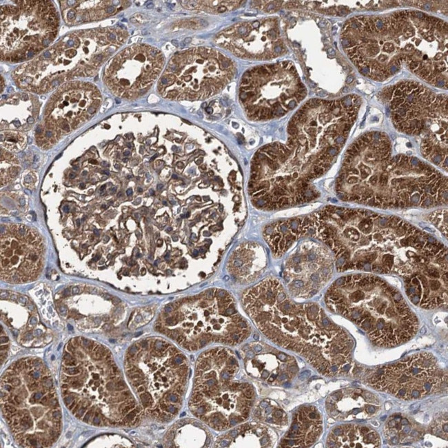 RhoBTB1 Antibody in Immunohistochemistry (Paraffin) (IHC (P))