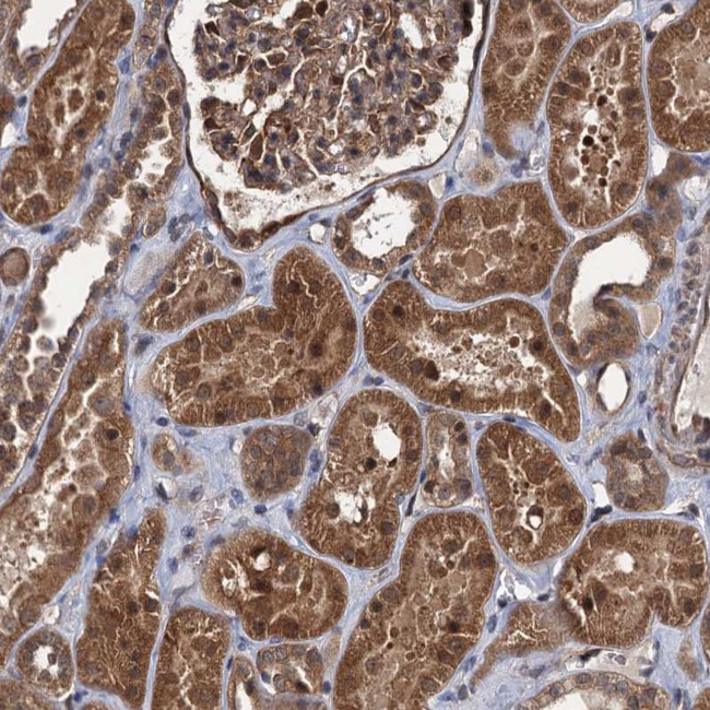 ZFYVE19 Antibody in Immunohistochemistry (Paraffin) (IHC (P))