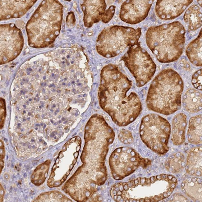 M6PR Antibody in Immunohistochemistry (Paraffin) (IHC (P))