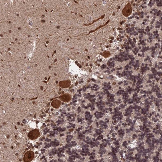 ORP1 Antibody in Immunohistochemistry (Paraffin) (IHC (P))