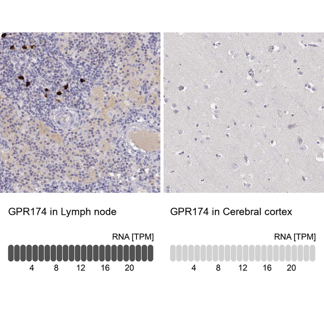 GPR174 Antibody in Immunohistochemistry (Paraffin) (IHC (P))