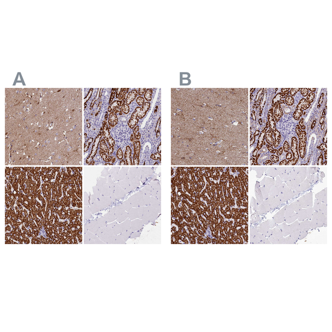 ABAT Antibody in Immunohistochemistry (Paraffin) (IHC (P))