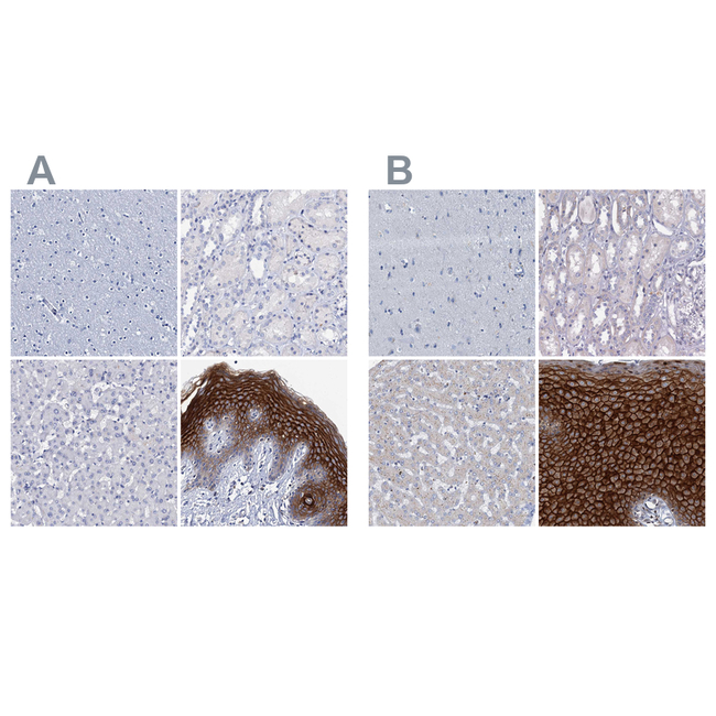 LYPD3 Antibody in Immunohistochemistry (Paraffin) (IHC (P))