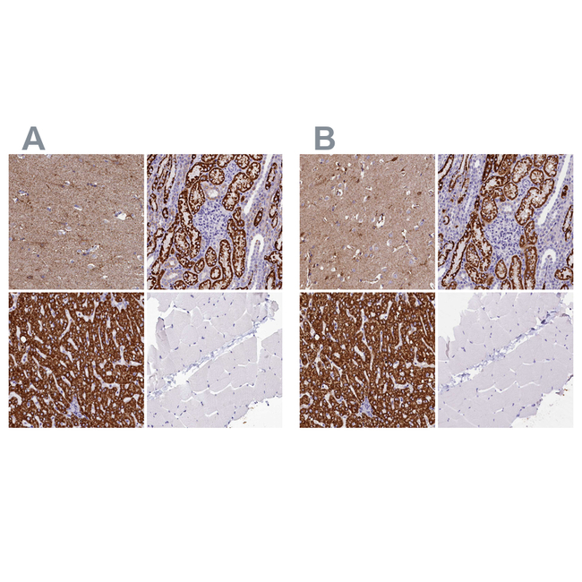 ABAT Antibody in Immunohistochemistry (Paraffin) (IHC (P))