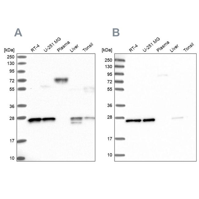 MESDC2 Antibody in Western Blot (WB)