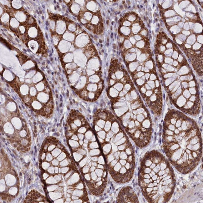 PAF1 Antibody in Immunohistochemistry (Paraffin) (IHC (P))