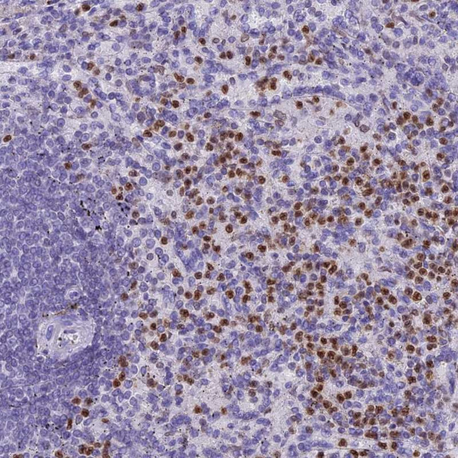 IL17B Antibody in Immunohistochemistry (Paraffin) (IHC (P))