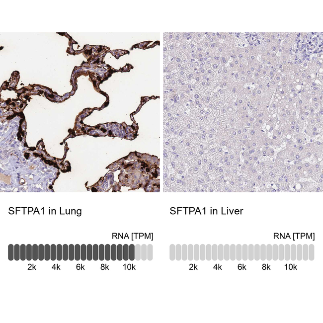 SFTPA1 Antibody in Immunohistochemistry (Paraffin) (IHC (P))