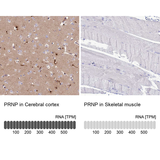 PrP Antibody in Immunohistochemistry (Paraffin) (IHC (P))