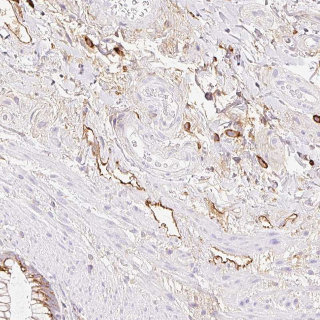 LYVE1 Antibody in Immunohistochemistry (Paraffin) (IHC (P))