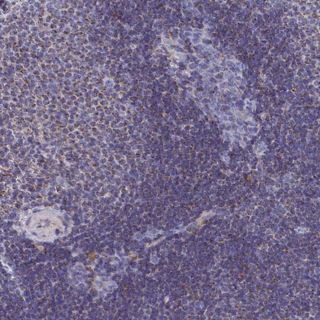 CCRL2 Antibody in Immunohistochemistry (Paraffin) (IHC (P))