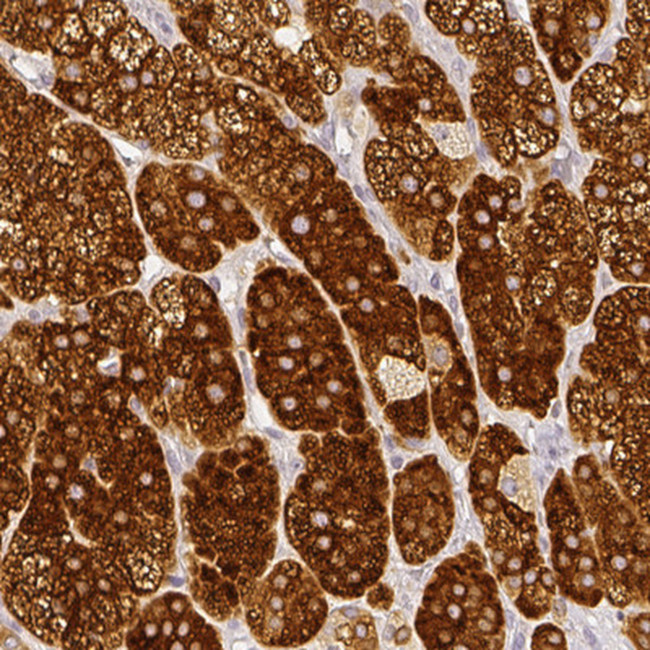 HSD3B1 Antibody in Immunohistochemistry (Paraffin) (IHC (P))