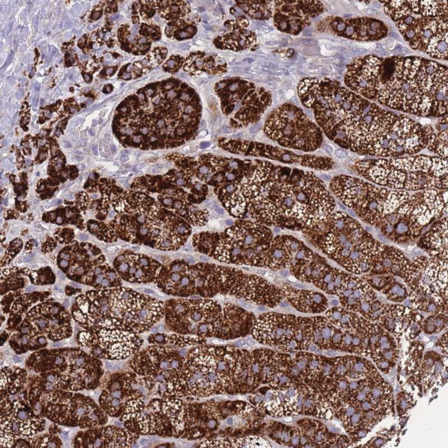 PDE4A Antibody in Immunohistochemistry (Paraffin) (IHC (P))
