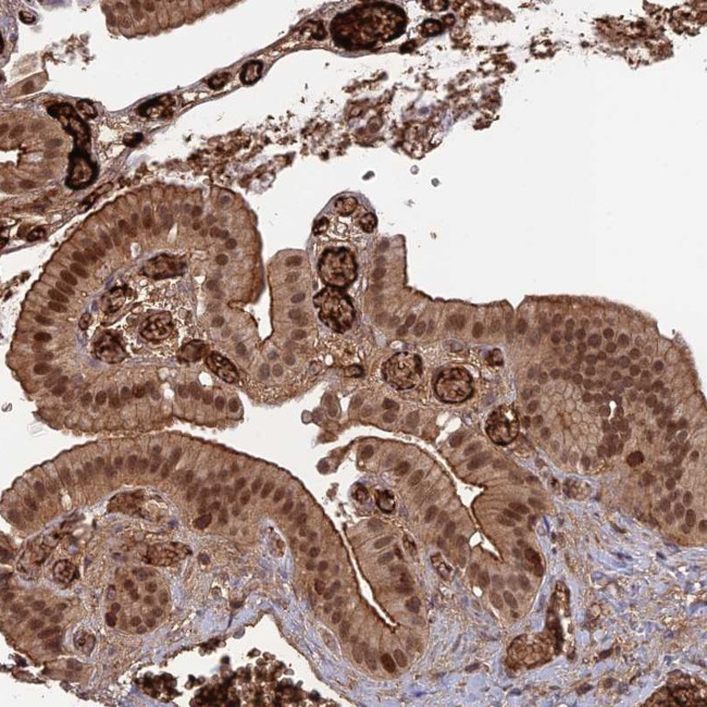 ORP1 Antibody in Immunohistochemistry (Paraffin) (IHC (P))