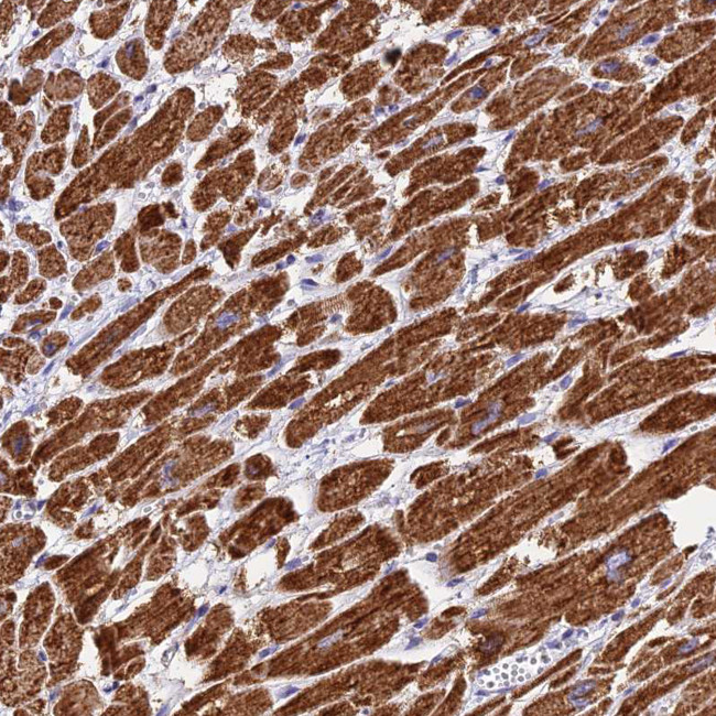 VDAC2 Antibody in Immunohistochemistry (Paraffin) (IHC (P))