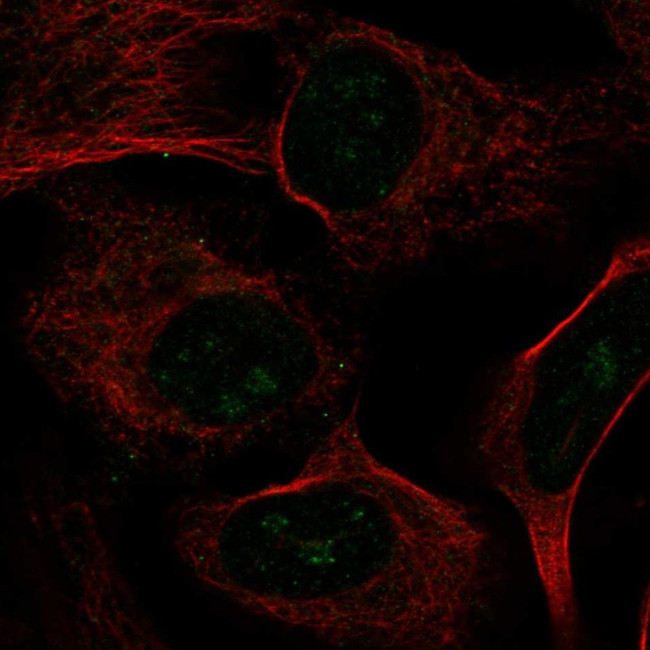 CIRH1A Antibody in Immunocytochemistry (ICC/IF)
