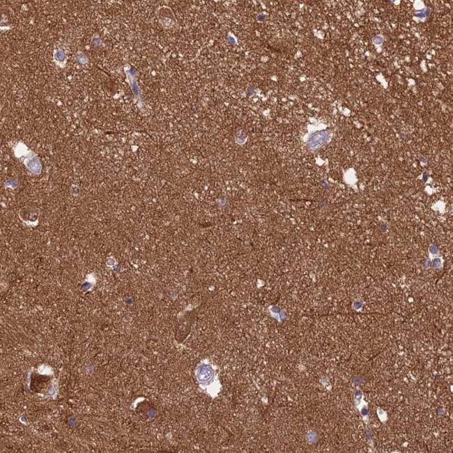 RanBP16 Antibody in Immunohistochemistry (Paraffin) (IHC (P))
