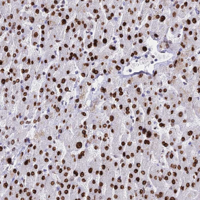 Histone H1.1 Antibody in Immunohistochemistry (Paraffin) (IHC (P))