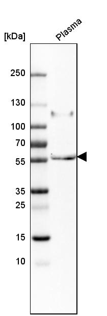 PI16 Antibody in Western Blot (WB)