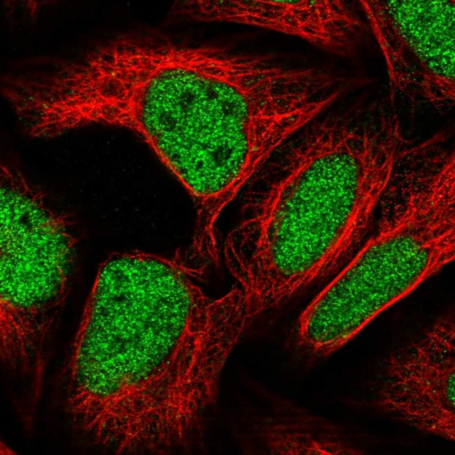 ZBTB22 Antibody in Immunocytochemistry (ICC/IF)