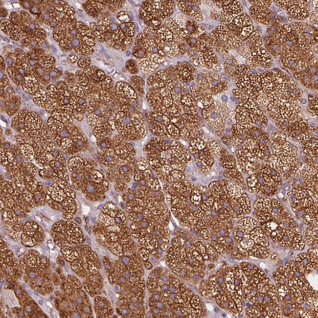 HSD3B1 Antibody in Immunohistochemistry (Paraffin) (IHC (P))