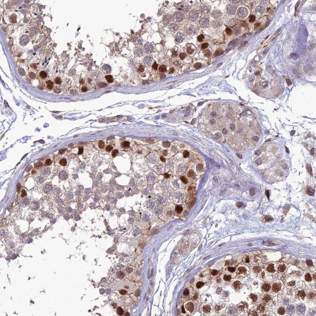 TSPYL2 Antibody in Immunohistochemistry (Paraffin) (IHC (P))