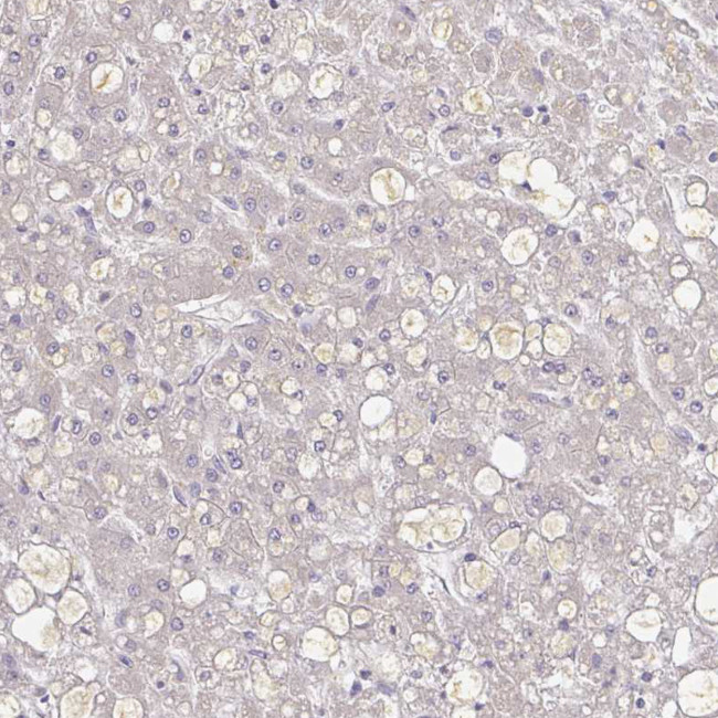 A1BG Antibody in Immunohistochemistry (Paraffin) (IHC (P))