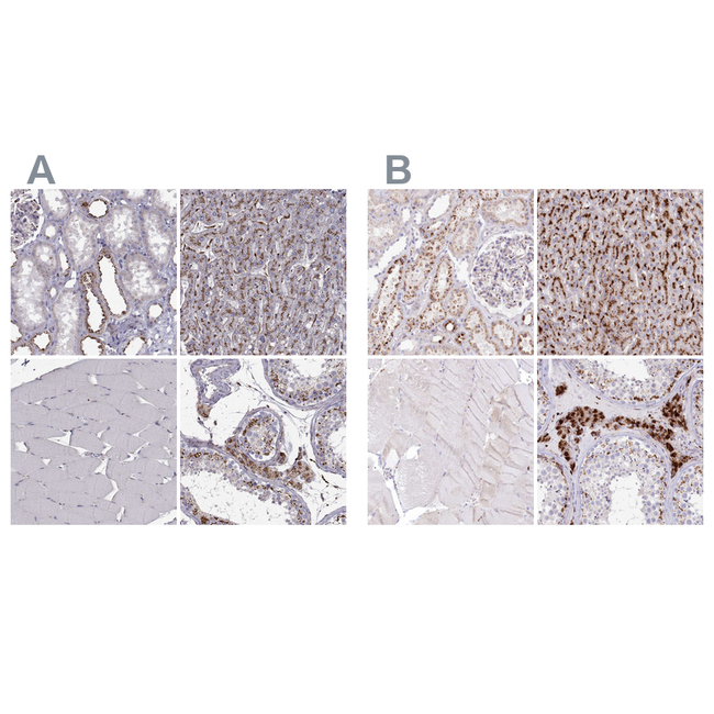 CLN2 Antibody in Immunohistochemistry (Paraffin) (IHC (P))