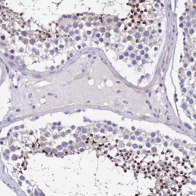 UBE2L3 Antibody in Immunohistochemistry (Paraffin) (IHC (P))