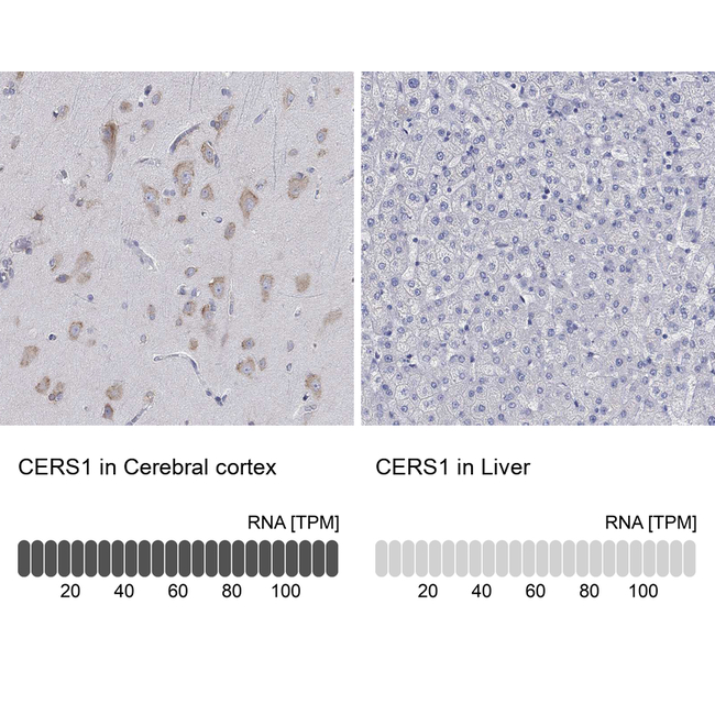 Lass1 Antibody in Immunohistochemistry (Paraffin) (IHC (P))