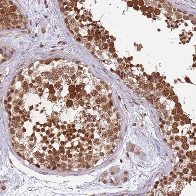 CEP170 Antibody in Immunohistochemistry (Paraffin) (IHC (P))