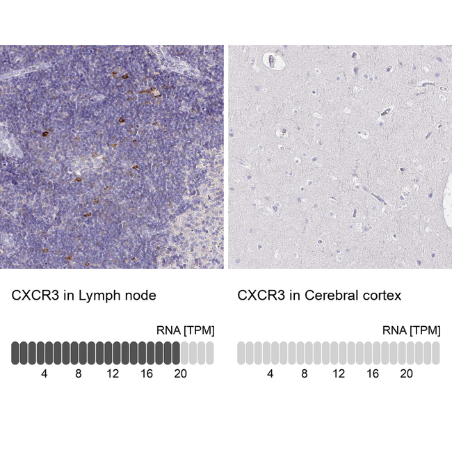 CXCR3 Antibody in Immunohistochemistry (Paraffin) (IHC (P))