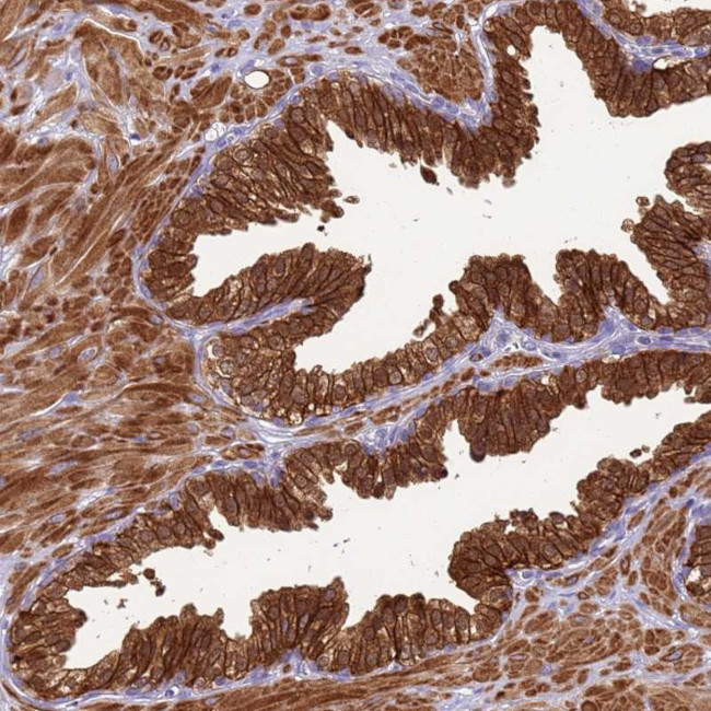 KLHL9 Antibody in Immunohistochemistry (Paraffin) (IHC (P))