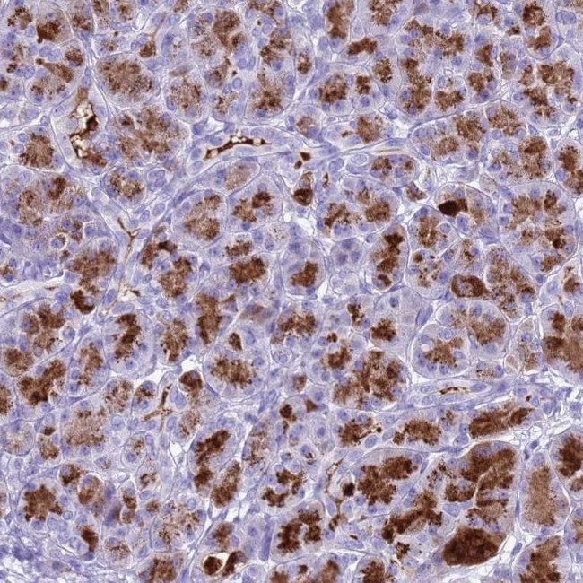 Bestrophin 2 Antibody in Immunohistochemistry (Paraffin) (IHC (P))