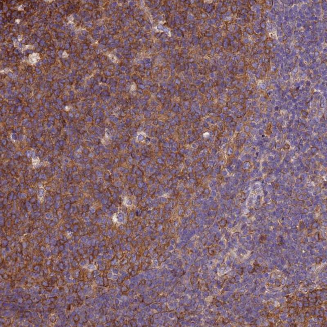 beta Tubulin Antibody in Immunohistochemistry (Paraffin) (IHC (P))