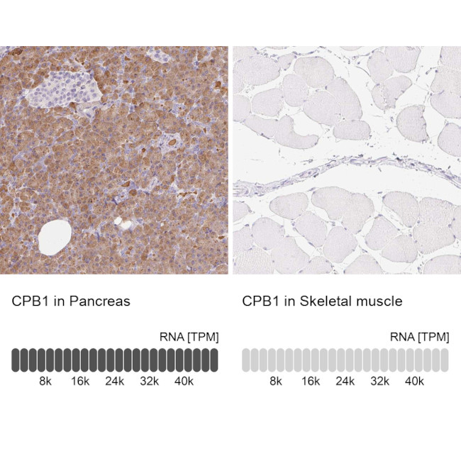 Carboxypeptidase B1 Antibody in Immunohistochemistry (Paraffin) (IHC (P))
