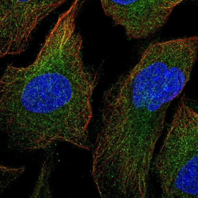 MEKK1 Antibody in Immunocytochemistry (ICC/IF)