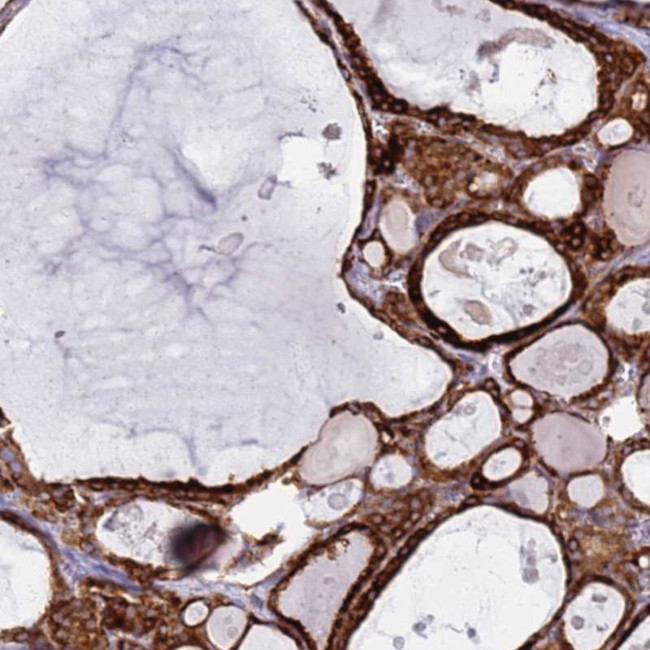PDK3 Antibody in Immunohistochemistry (Paraffin) (IHC (P))