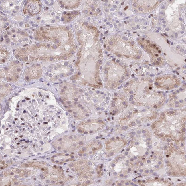 ERG Antibody in Immunohistochemistry (Paraffin) (IHC (P))