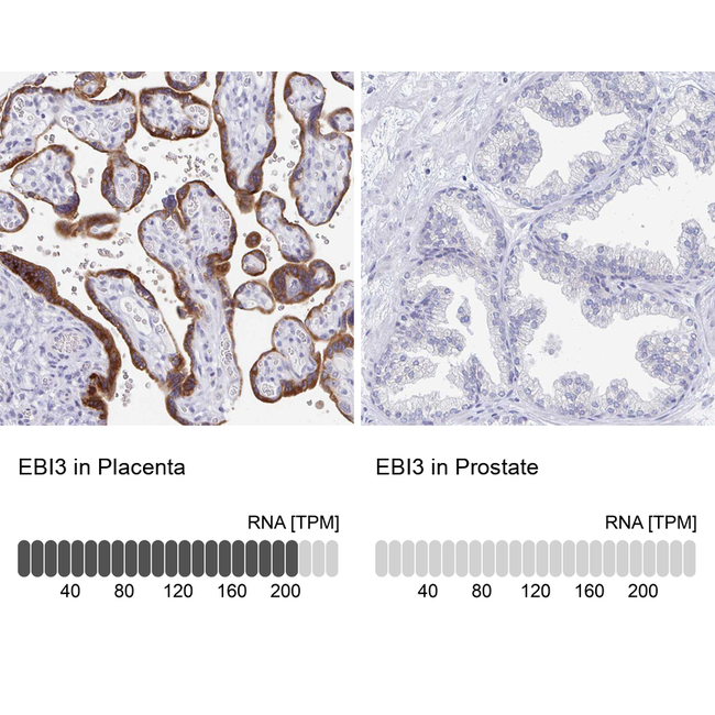 EBI3 Antibody in Immunohistochemistry (Paraffin) (IHC (P))