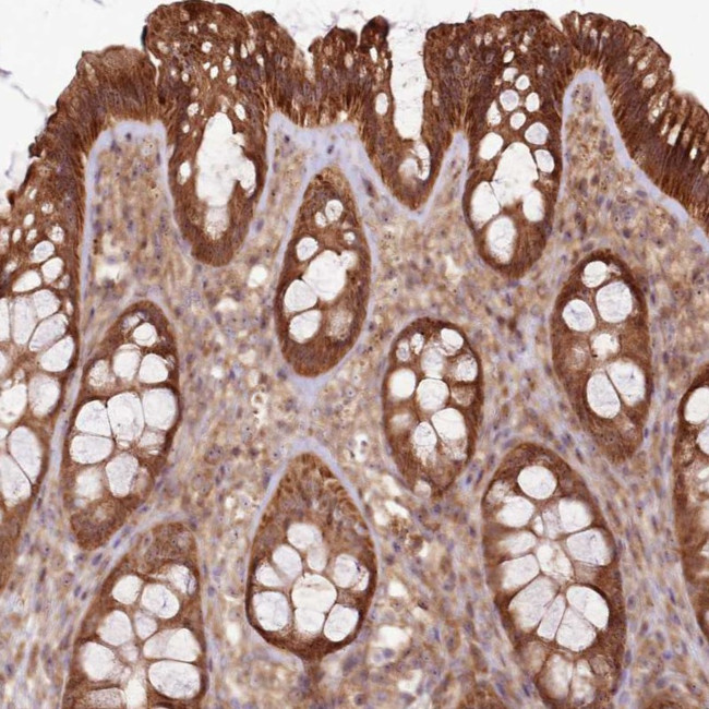 RASA3 Antibody in Immunohistochemistry (Paraffin) (IHC (P))