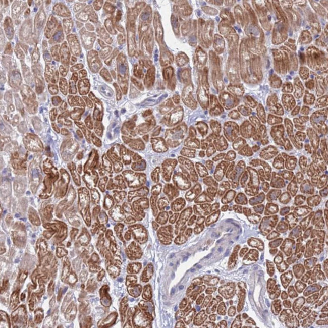 FBXO27 Antibody in Immunohistochemistry (Paraffin) (IHC (P))