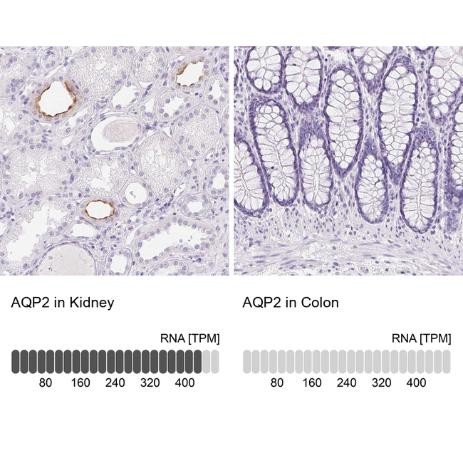 Aquaporin 2 Antibody in Immunohistochemistry (Paraffin) (IHC (P))