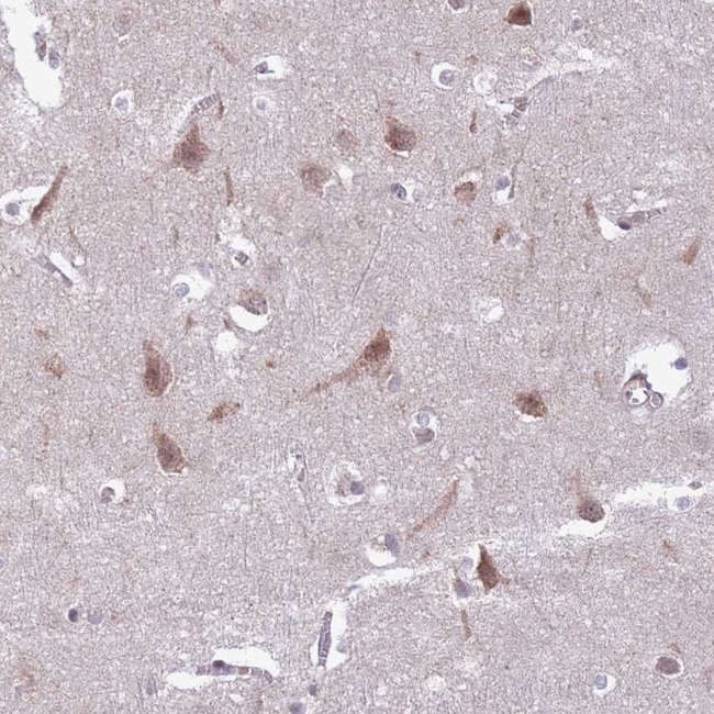 FUT3 Antibody in Immunohistochemistry (Paraffin) (IHC (P))