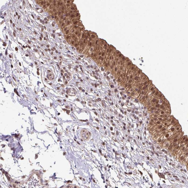 HIP Antibody in Immunohistochemistry (Paraffin) (IHC (P))