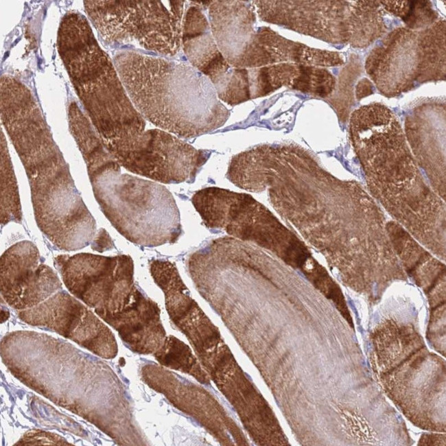 MEL18 Antibody in Immunohistochemistry (Paraffin) (IHC (P))