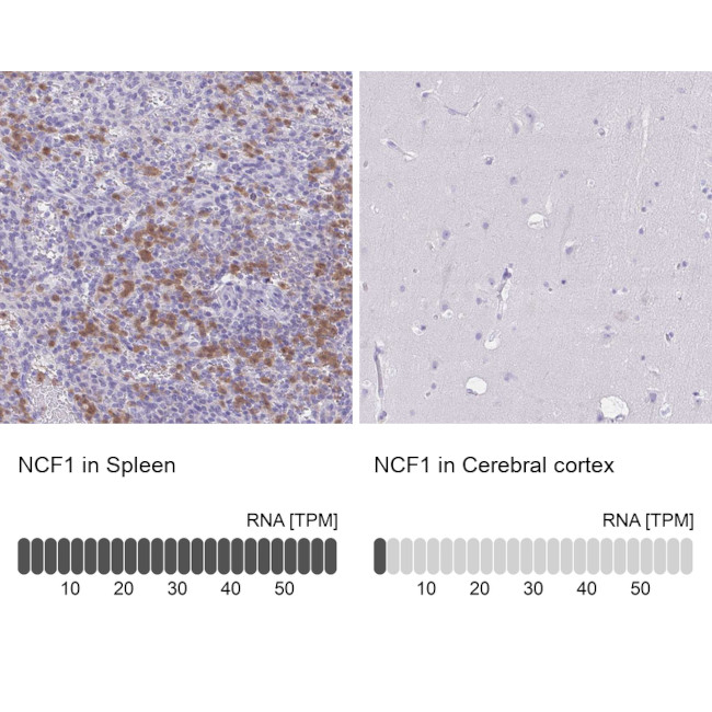 p47phox Antibody in Immunohistochemistry (Paraffin) (IHC (P))