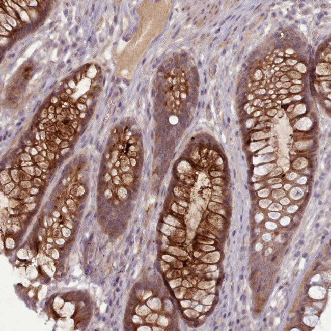 LEFTY Antibody in Immunohistochemistry (Paraffin) (IHC (P))