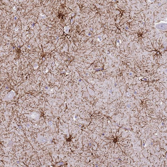 RanBP16 Antibody in Immunohistochemistry (Paraffin) (IHC (P))