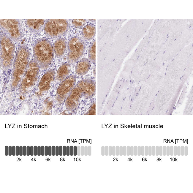 Lysozyme Antibody in Immunohistochemistry (Paraffin) (IHC (P))